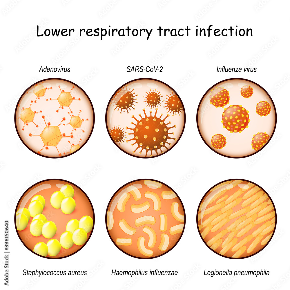 respiratory infection. Close-up of viruses and bacteria respiratory infection. Close-up of viruses and bacteria