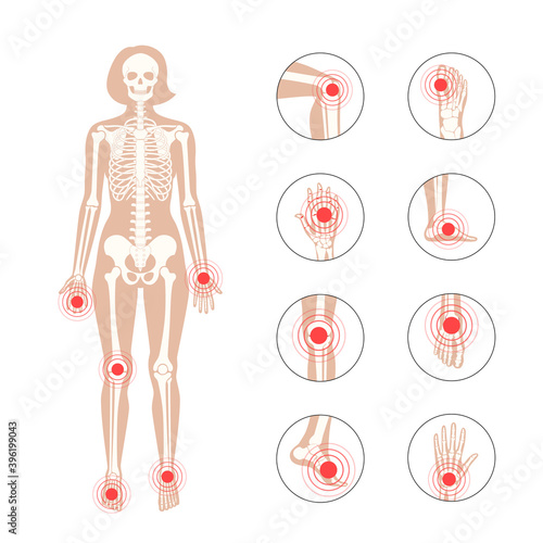 Normal bones concept