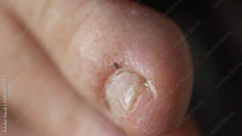 ugly man toes, close up of foot finger nails ugly man toes, close up of foot finger nails