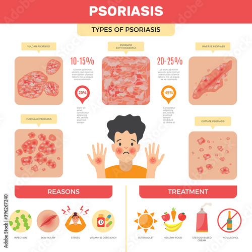 Psoriasis infographic. Human skin infection psoriasis diagnosis vector medical pictures. Care skin, human dermatitis and disease inflammation illustration