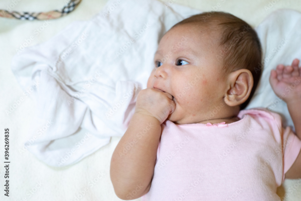 Blurry Asian Baby Girl Laying In Bed Looking Away/ Asian Baby Girl with her Hand in her mouth / Scars On Baby Girl's Face Blurry Asian Baby Girl Laying In Bed Looking Away/ Asian Baby Girl with her Hand in her mouth / Scars On Baby Girl's Face