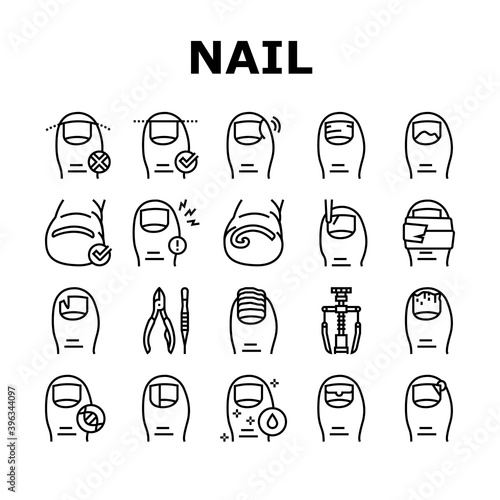 Ingrown Nail Disease Collection Icons Set Vector. Psoriasis And Onychomycosis, Nail Dark Spots And Surgical Intervention Medical Therapy Black Contour Illustrations