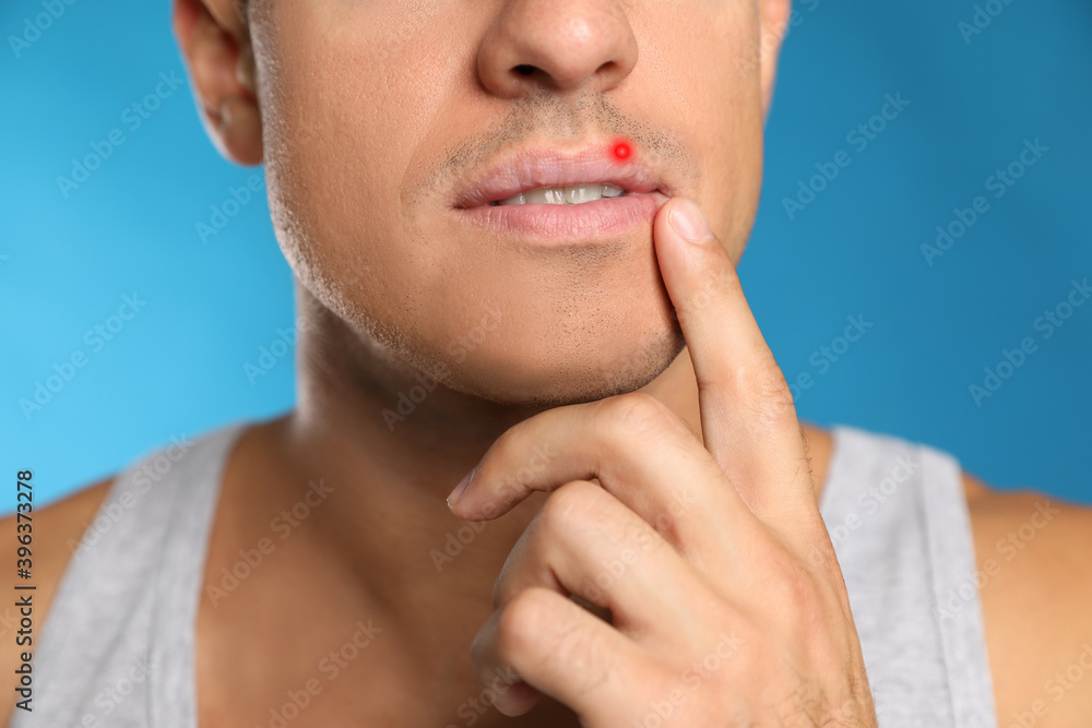 Obraz premium Man with herpes touching lip against light blue background, closeup