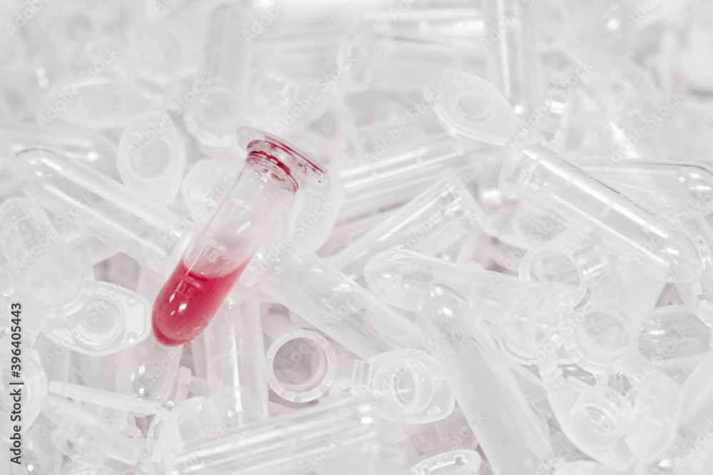 Foto de Used microcentrifuge eppendorf tubes with red fluid or blood