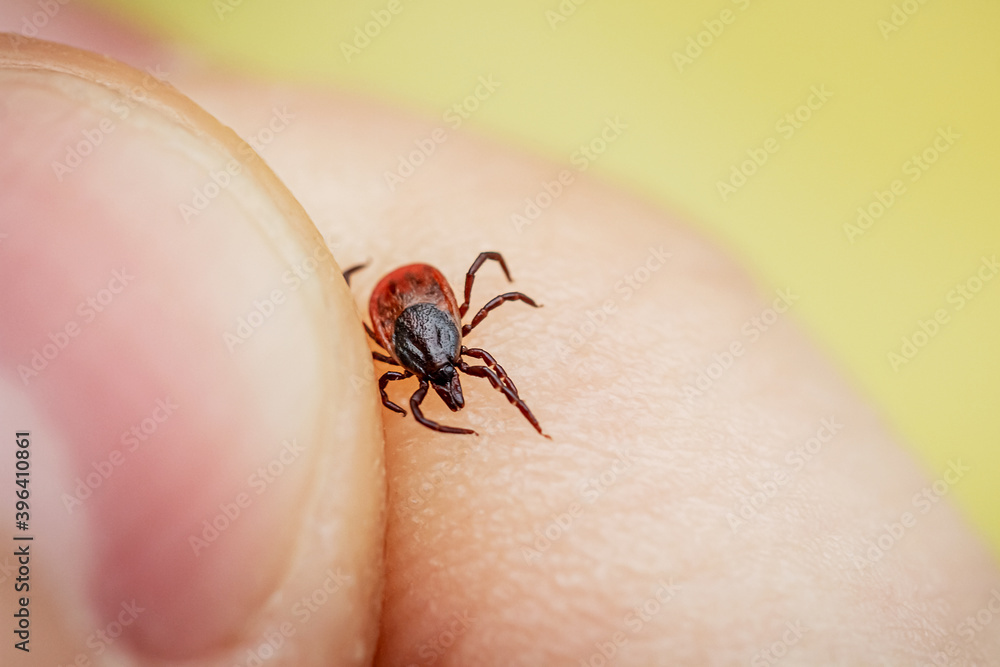 Obraz premium Dangerous blood sucking tick crawling on human skin is caught by hand. Parasite allergenic beetle