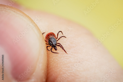 Dangerous blood sucking tick crawling on human skin is caught by hand. Parasite allergenic beetle © Komarov Dmitriy