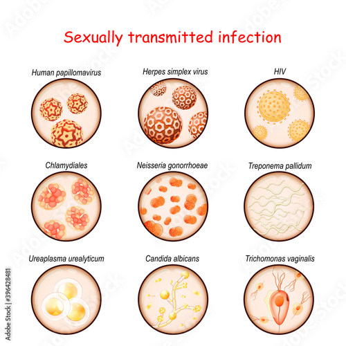 Sexually transmitted infection. Close-up of causative agents of Venereal disease