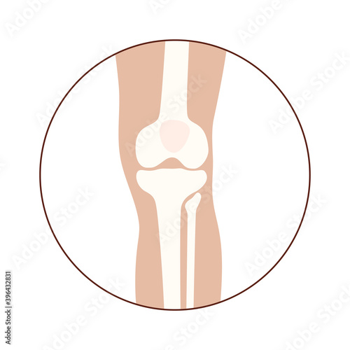 Normal bones concept