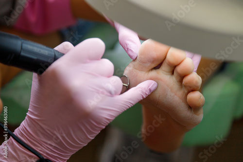 Women's feet and pedicure master. Professional hardware pedicure in a medical salon. Grinding rough skin on the foot with an abrasive disc. Visiting an orthopedic podiatrist.