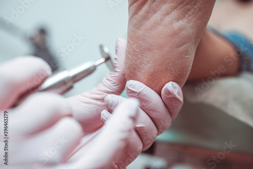 Women s feet and pedicure master. Professional hardware pedicure in a medical salon. Grinding rough skin on the heel with an abrasive disc. Visiting an orthopedic podiatrist.
