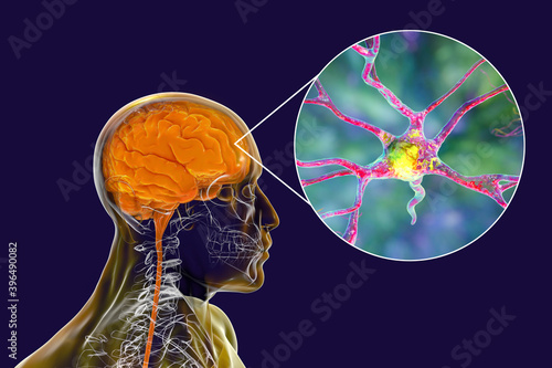 Schilderij op canvas Human brain with closeup view of brain cells, neurons