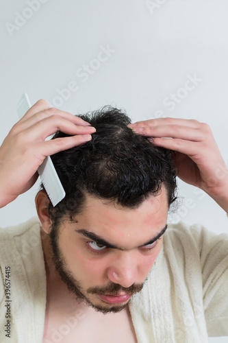 Caucasian young man worried about hair loss and looking in the mirror at his receding hair. Controls hair loss.