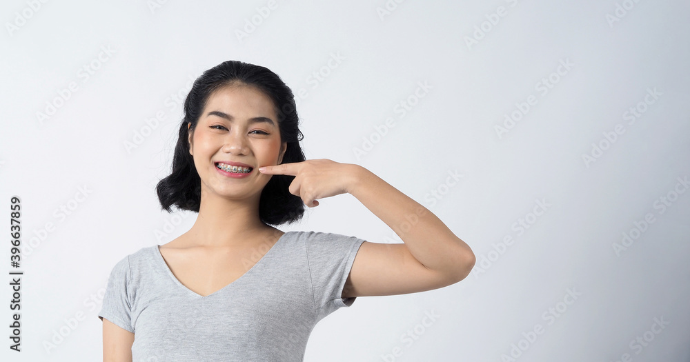 Dental braces of teen asian woman wearing braces teeth and contact lenses, she very confident and proudly present herself and smile on white background studio shot, Happiness teenager smiling facial Dental braces of teen asian woman wearing braces teeth and contact lenses, she very confident and proudly present herself and smile on white background studio shot, Happiness teenager smiling facial
