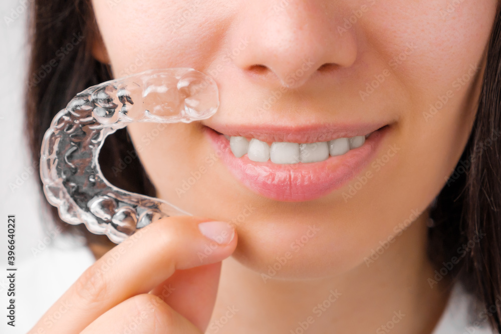 Close up woman holding a transparent removable braces for perfect smile. Orthodontic aligners for straightening and whitening teeth.