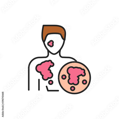 Atopic dermatitis line color icon. Sign for web page, mobile app