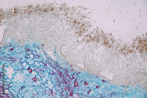 Penicillium, ascomycetous fungi are of major importance in the natural environment as well as food and drug production. 
 photo