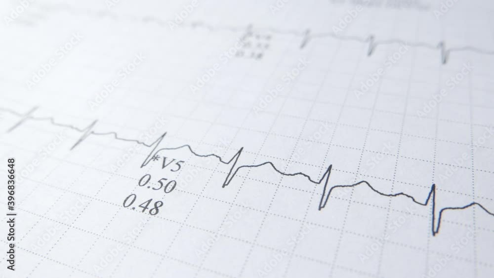 close up of cardio diagram on paper close up of cardio diagram on paper