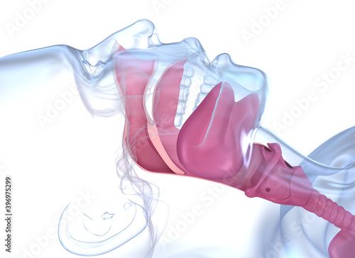 Sleep apnea syndrome. Labeled nasal tongue blocked airway, 3D animation photo