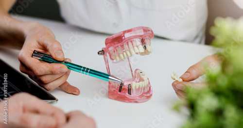 dentist implantologist showing dental implant technology on tooth jaw model to patient. visit in clinic office photo