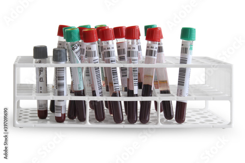 Test tubes with blood.