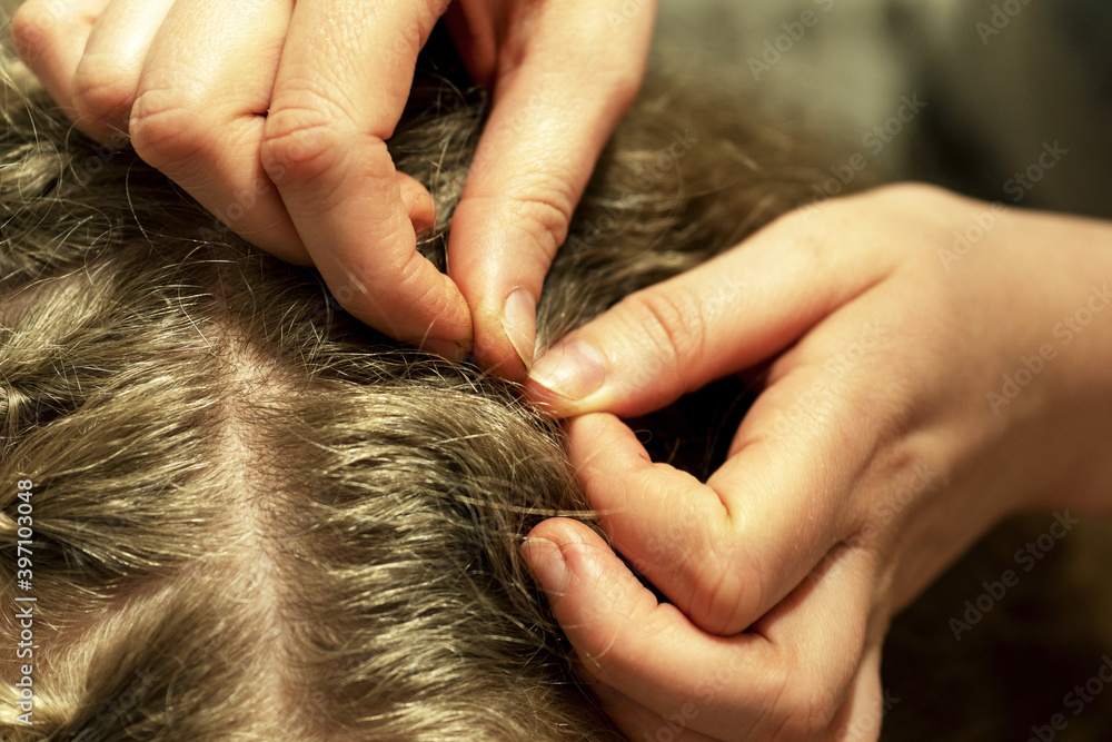 Fototapeta premium lice, head, louse, scratching, women, child