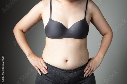 fat woman cellulite belly unhealthy © 1827photography