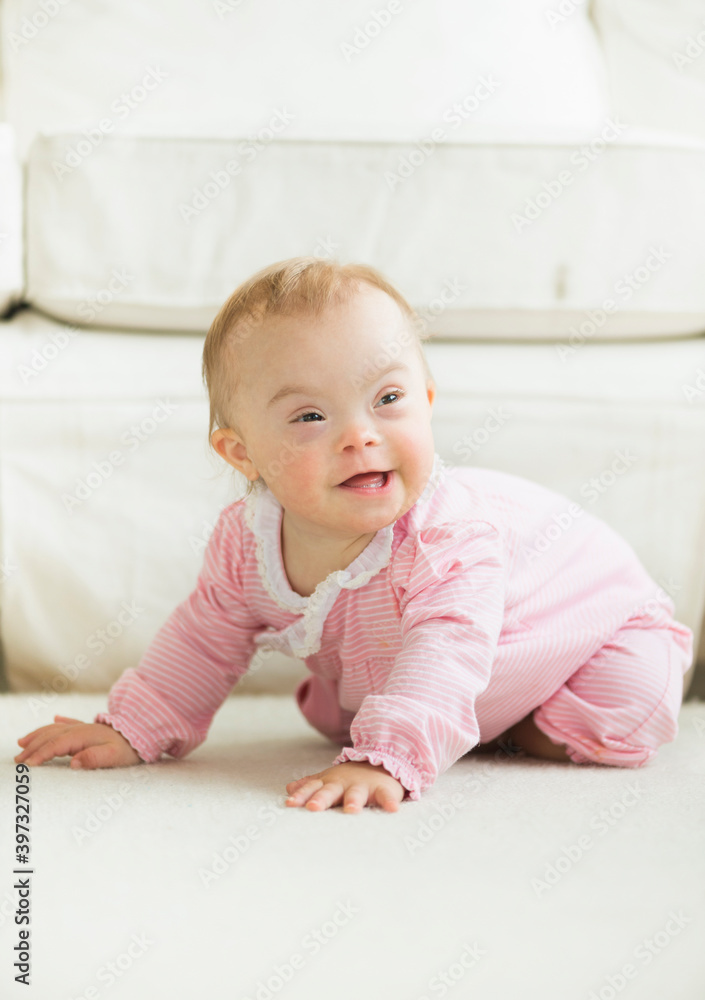 Caucasian baby girl with Down Syndrome Caucasian baby girl with Down Syndrome