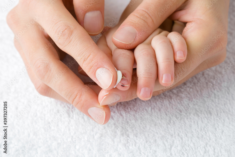 Young adult woman hand holding baby hand and applying medical ointment on scratched finger and beaten fingernail on white towel. Mother giving first aid. Closeup. Front view.