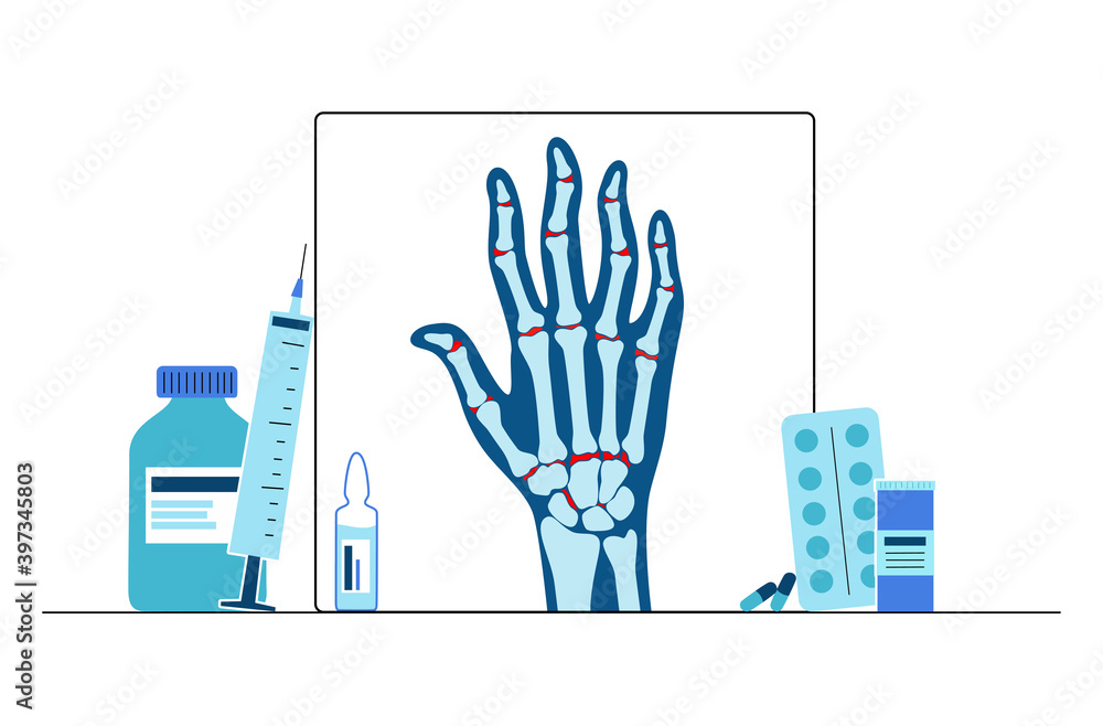 Obraz premium Arthritis poster concept