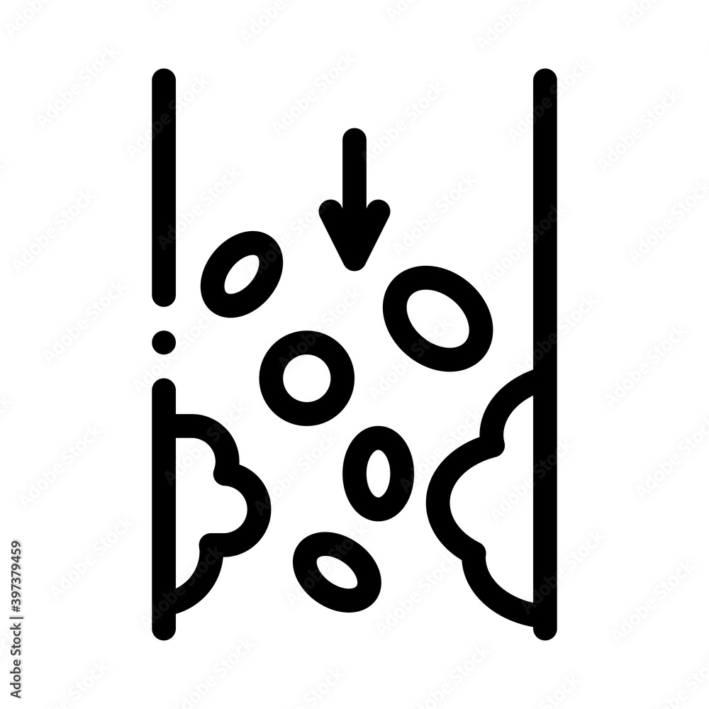 atherosclerosis vessel problem black icon vector. atherosclerosis vessel problem sign. isolated symbol illustration atherosclerosis vessel problem black icon vector. atherosclerosis vessel problem sign. isolated symbol illustration