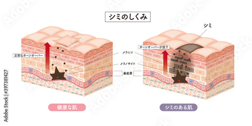 Cross section of the skin 2