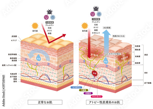 Cross section of the skin 3