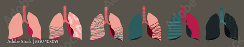 vector set of human's lungs, stages of cancer