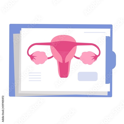 Uterine adhesions. Asherman's sydnrome symptom. Female infertility.