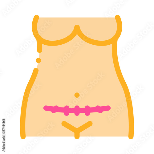 cesarean section color icon vector. cesarean section sign. isolated symbol illustration