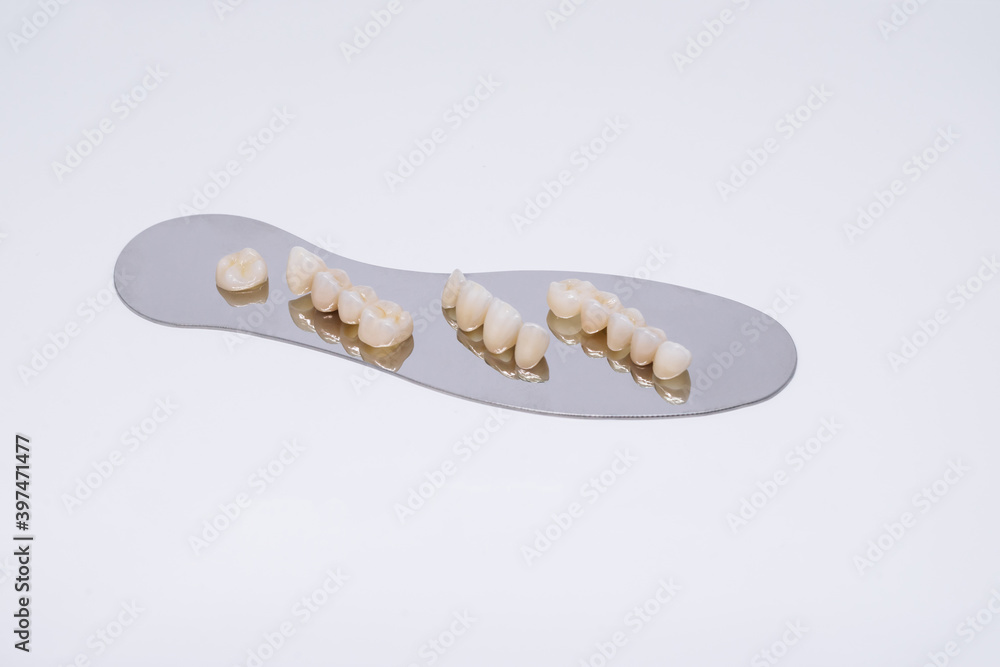 Metal free ceramic dental crowns. Zirconium tooth crown Isolate on wite