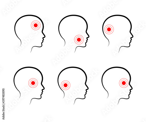 Types of headaches on a white background. Icon. Vector illustration.