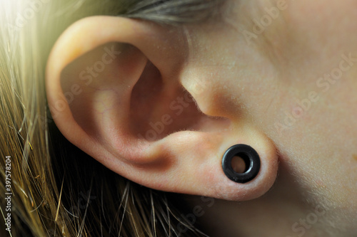 Print op canvas View of a ear piercing with a larger ring