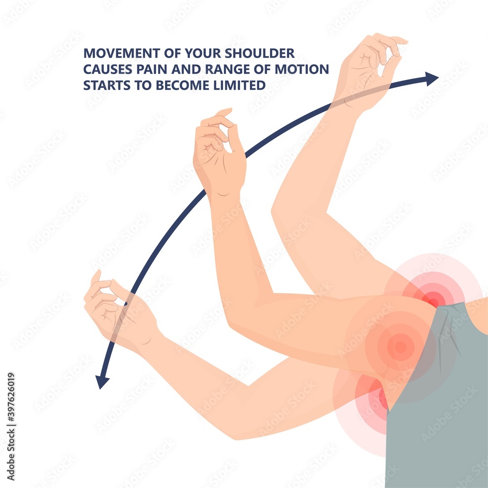 Frozen shoulder adhesive capsulitis surgery stiff crush ribs bone lift