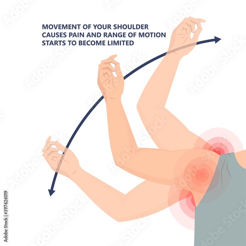 Frozen shoulder adhesive capsulitis surgery stiff crush ribs bone lift athletes arm rupture symptom freezing stiffness rheumatoid arthritis