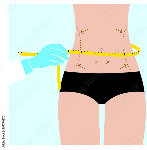 Woman waist plastic surgery in clinic. Vector illustration