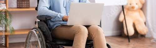 Cropped view of disabled psychologist using laptop with blurred office on background, banner