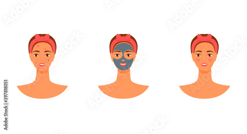 vector yang woman face mask. acne before and after. skin care flat illustration.