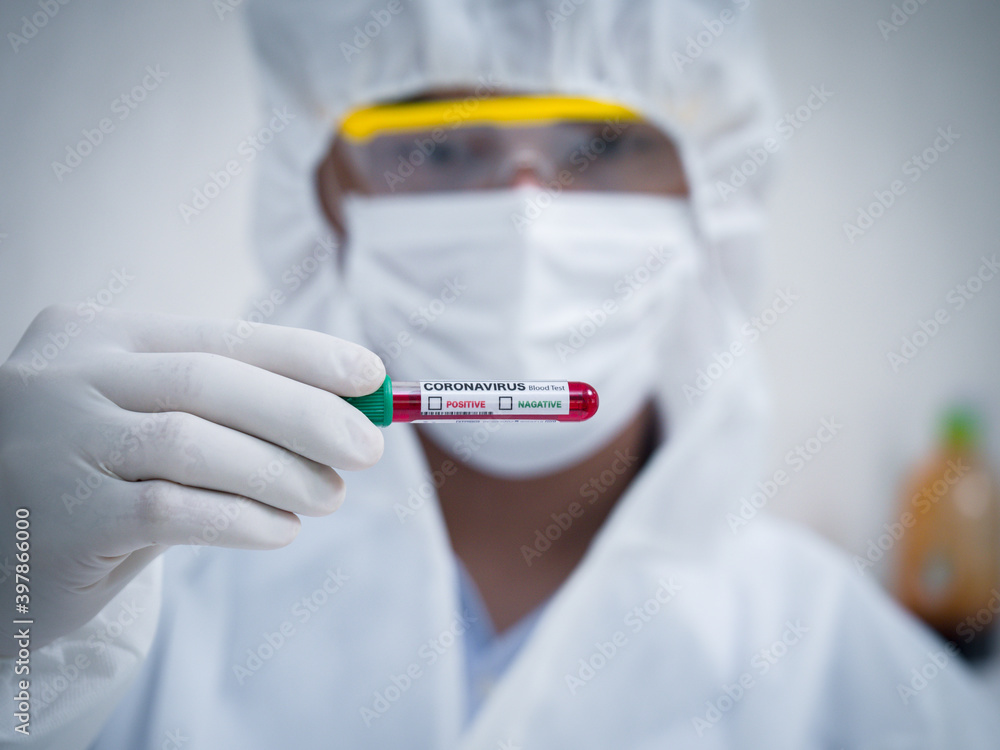 The lab staff is examining the blood results of a patient suspected of being infected with the coronavirus. The lab staff is examining the blood results of a patient suspected of being infected with the coronavirus.