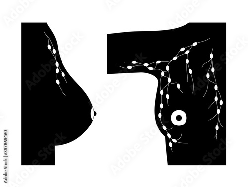 Breast disease concept