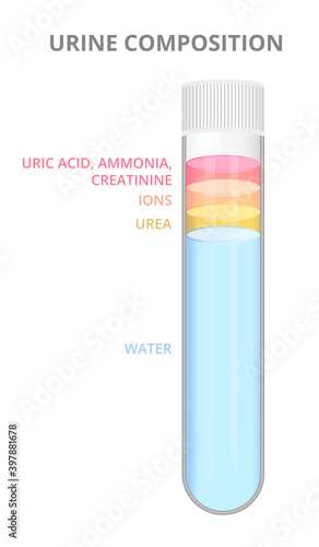 Urine composition, the composition of urine, urine components. Uric acid, ammonia, creatinine, ions, urea, and water. Laboratory glass test tube filled with urine sample isolated on white background.