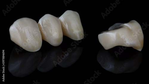 beautiful dental crowns ceramic inlays on a black background