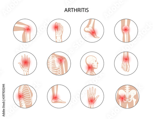 Human bones concept