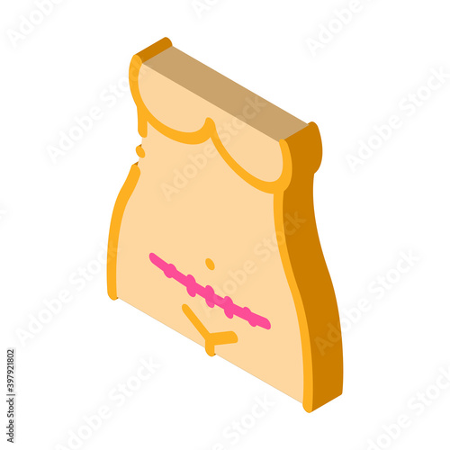 cesarean section color icon vector. isometric cesarean section sign. color isolated symbol illustration
