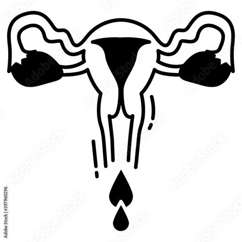 Extremely heavy period Vector Glyph Icon Design, In Vitro Fertilization Symbol on White Background, Pregnancy and obstetrician Sign, Abnormal Uterine Bleeding Concept, 
